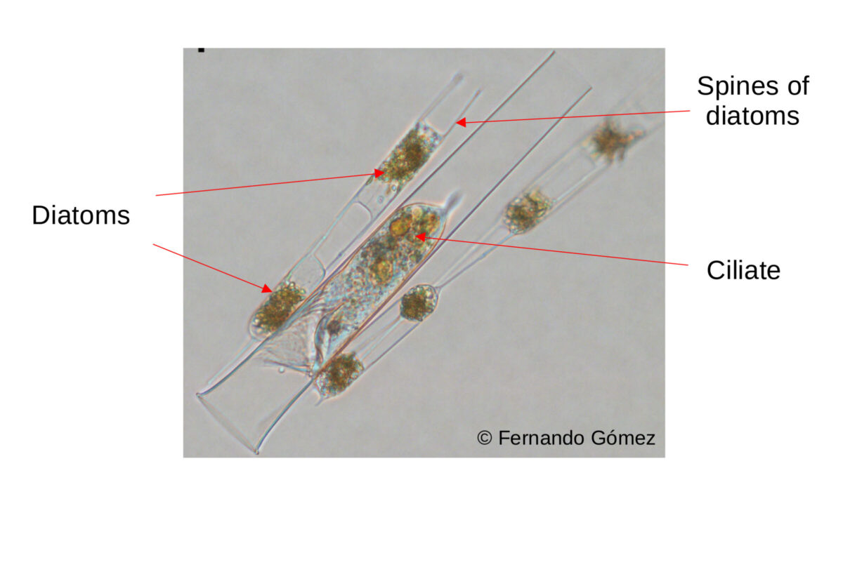 Figure 1 : Photographie démontrant le phénomène de symbiose entre diatomées et ciliées.